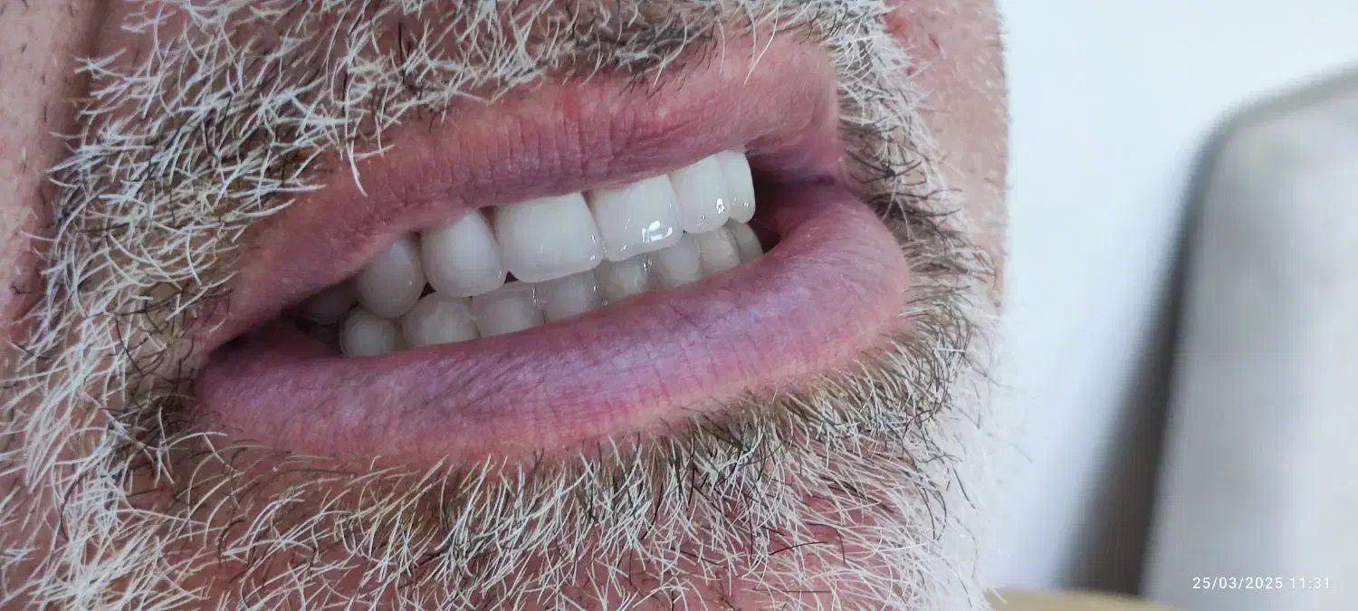 دندانسازی (فقط با ۱۵ میلیون )|خدمات آرایشگری و زیبایی|پرند, فاز ۲|دیوار