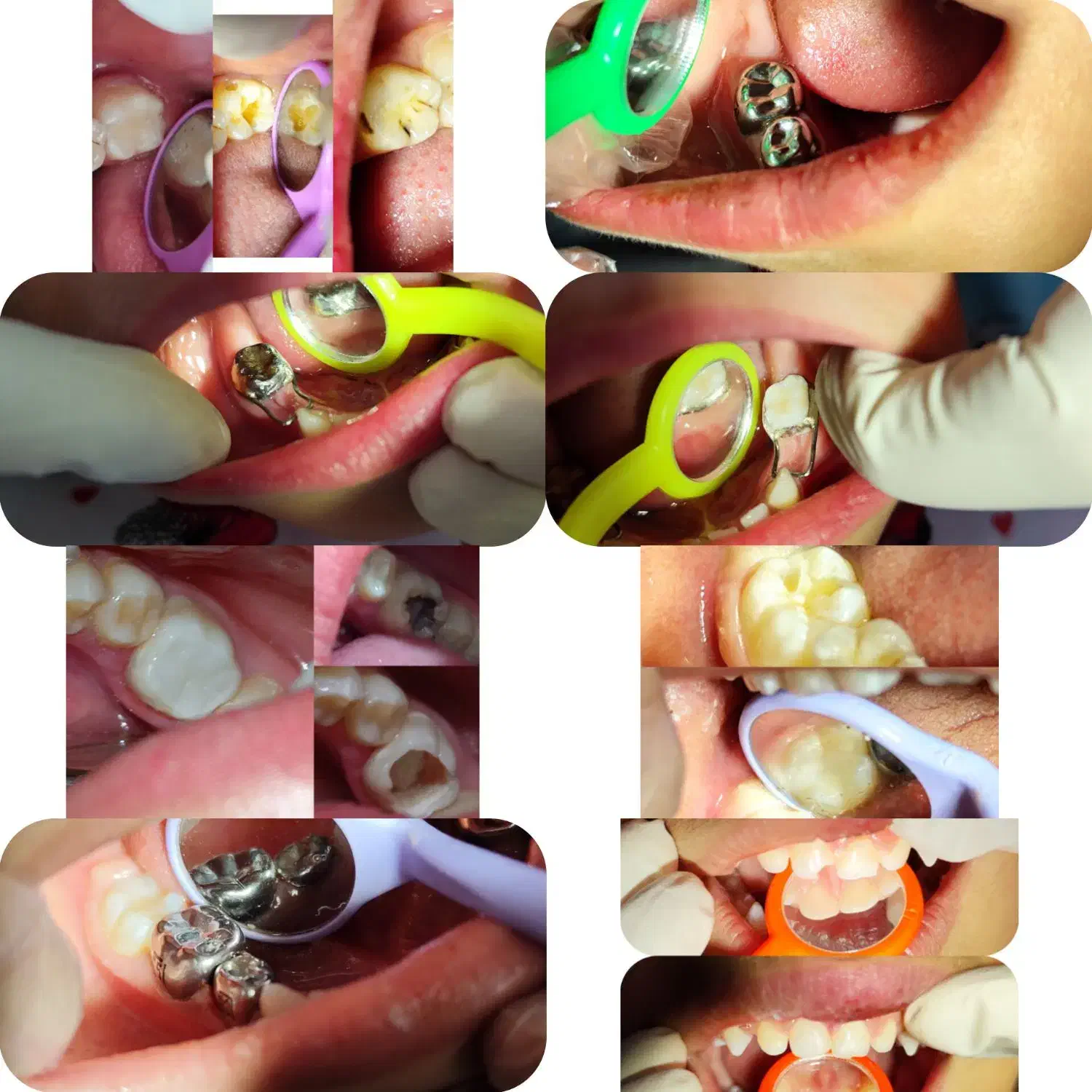 دندانپزشک کودکان دکتر ساداتشریفی|خدمات آرایشگری و زیبایی|شیراز, چوگیاه|دیوار