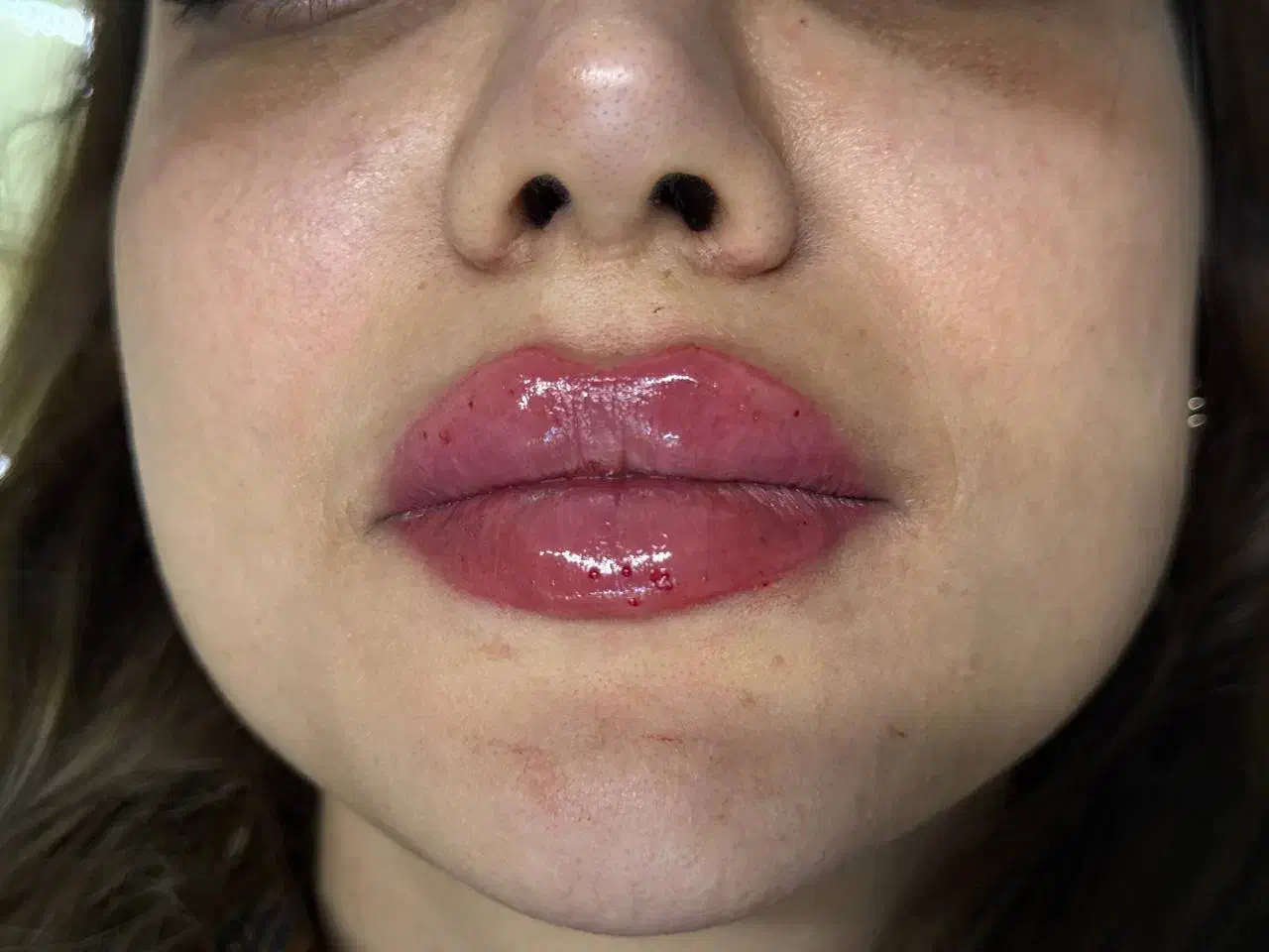 کلینیک تخصصی پوست،مو و زیبایی دکتر فاطمه عروجی|خدمات آرایشگری و زیبایی|تهران, مشیریه|دیوار