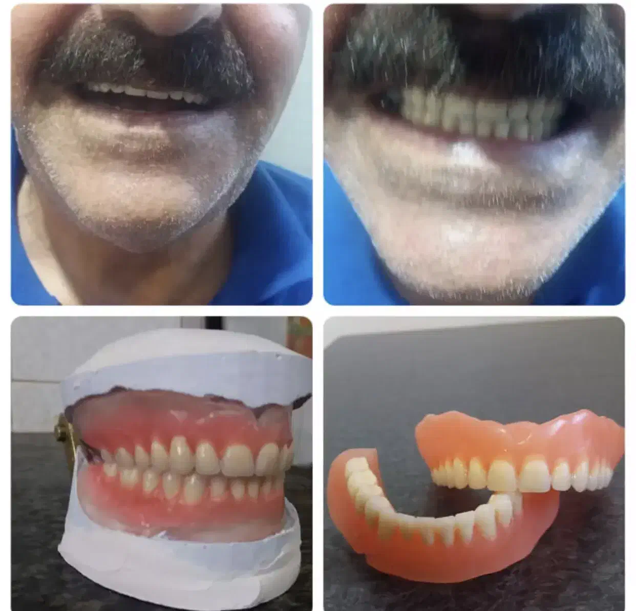 دندانسازی متحرک (مصنوعی)|خدمات آرایشگری و زیبایی|اهواز, شهرک دانشگاه|دیوار