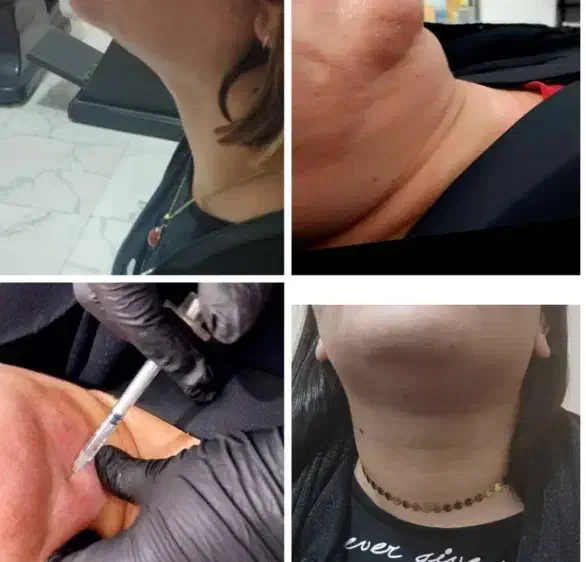 آموزش ژل و بوتاکس تضمینی|خدمات آموزشی|ایذه, |دیوار