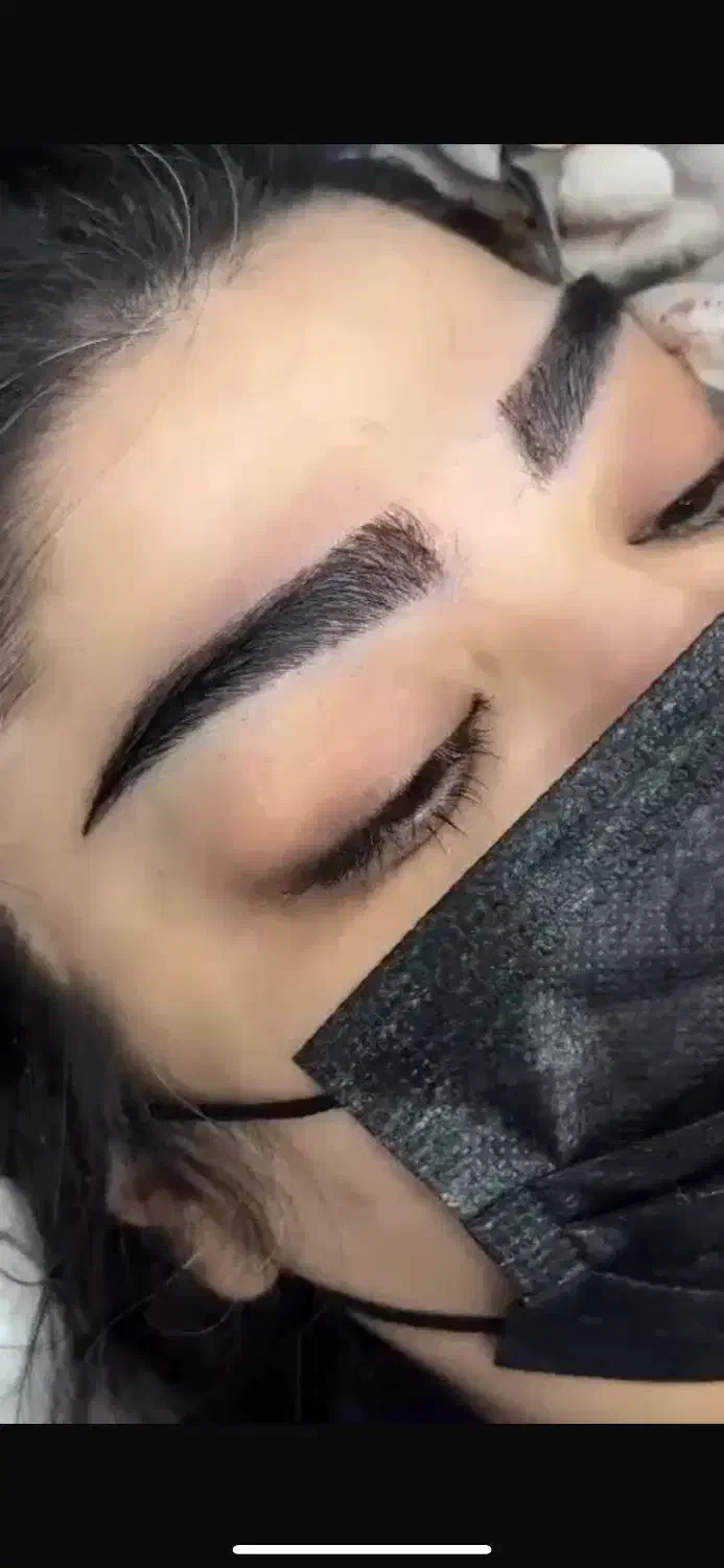 فیلر سی سی۳۳۰ بلفاروپلاستی ۶/۹۰۰ بوتاکس ۲۵۰|خدمات آرایشگری و زیبایی|تهران, صادقیه|دیوار