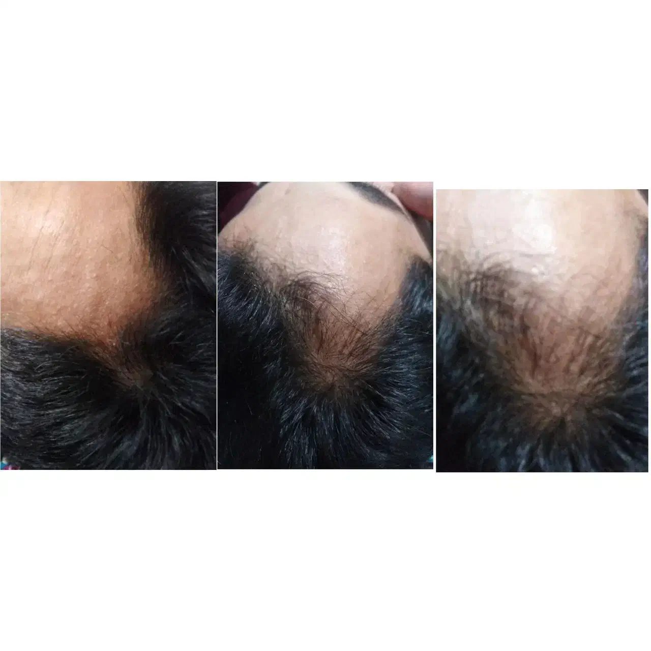 مو|آرایشی، بهداشتی، درمانی|تهران, فردوسی|دیوار