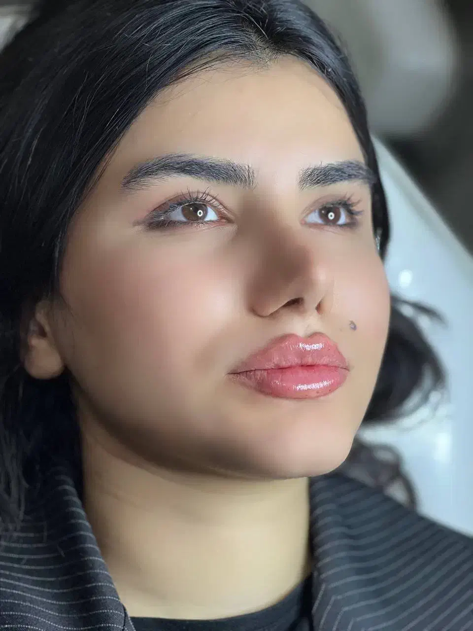 تزریق ژل وبوتاکس|خدمات آرایشگری و زیبایی|جوانرود, |دیوار