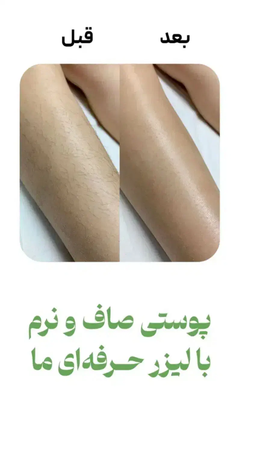 جشنواره پاییزی لیزر با دستگاه کندلا آمریکایی ۲۰۲۴|خدمات آرایشگری و زیبایی|اصفهان, سعادتآباد|دیوار