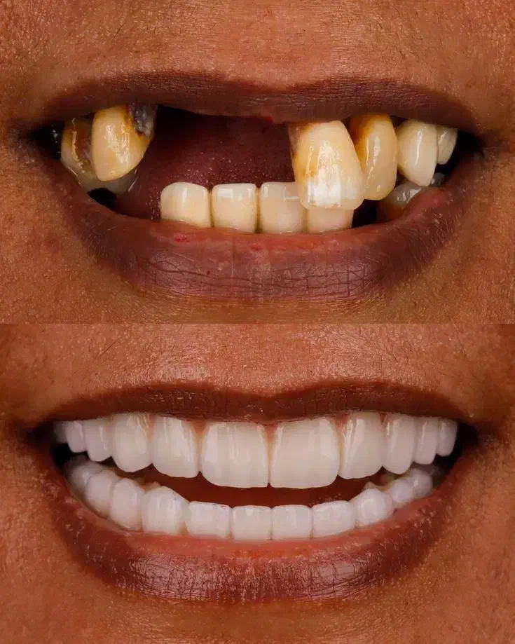 دندانپزشکی ایمپلنت اقساط ۱۲ ماهه|خدمات آرایشگری و زیبایی|تهران, میرداماد|دیوار