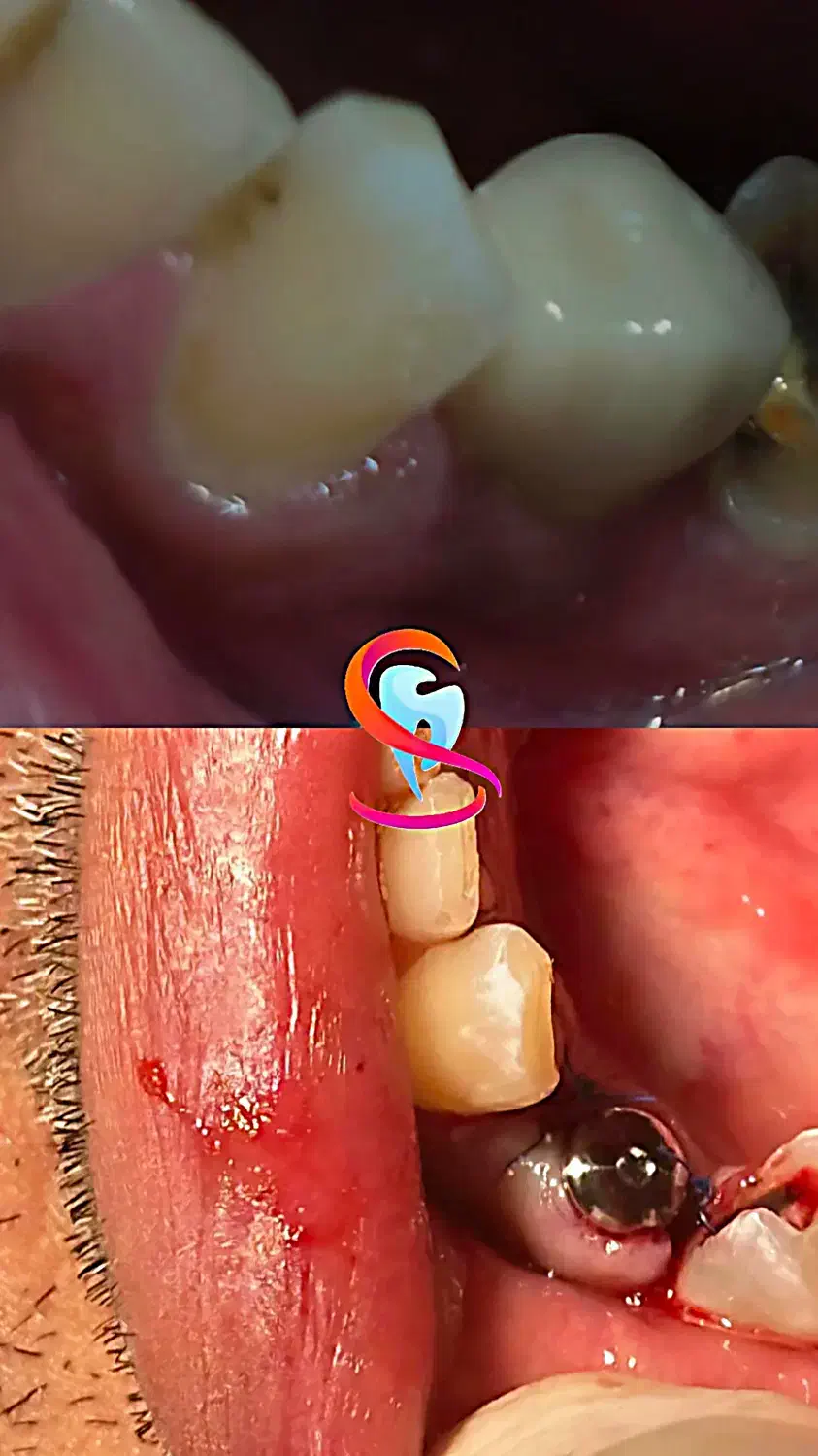 کاشت ایمپلنت و خدمات درمانی و زیبایی دندانپزشکی|خدمات آرایشگری و زیبایی|اصفهان, مهرآباد|دیوار