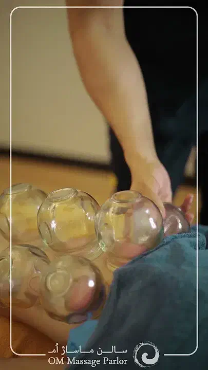 حجامت و بادکش گرم درمانی|خدمات آرایشگری و زیبایی|اصفهان, باغ فدک|دیوار