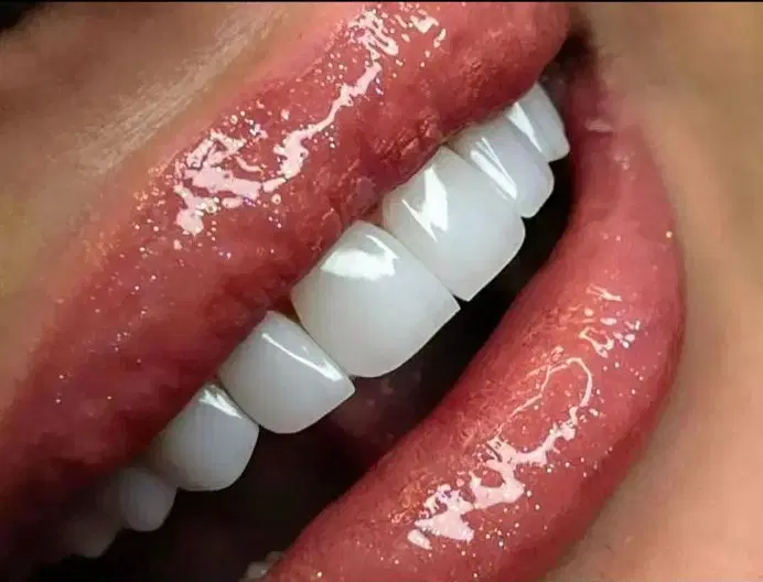 کلیه خدمات دندانپزشکی با تخفیفات طلایی|خدمات زیبایی و سلامت|کرمانشاه, |دیوار