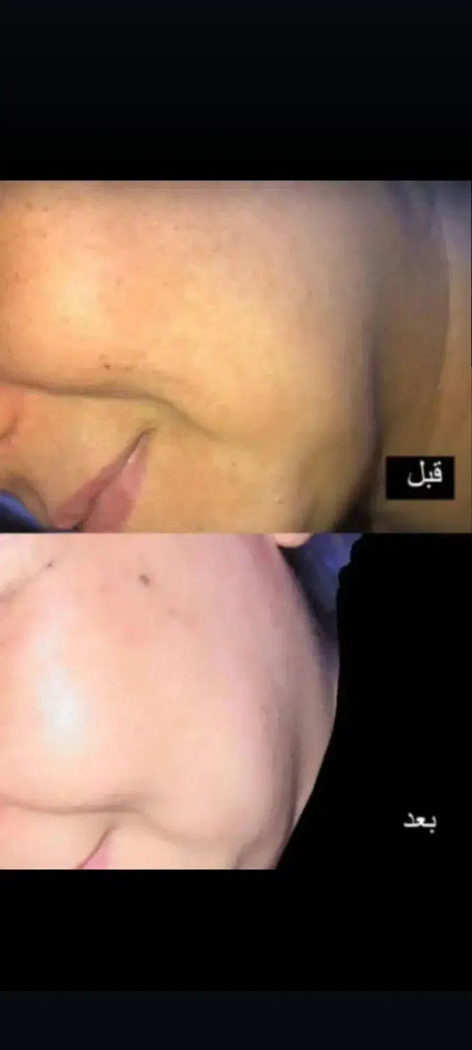 روشن کننده صورت و دست معجزه بشرط اصلی و گیاهی|آرایشی، بهداشتی، درمانی|یاسوج, |دیوار