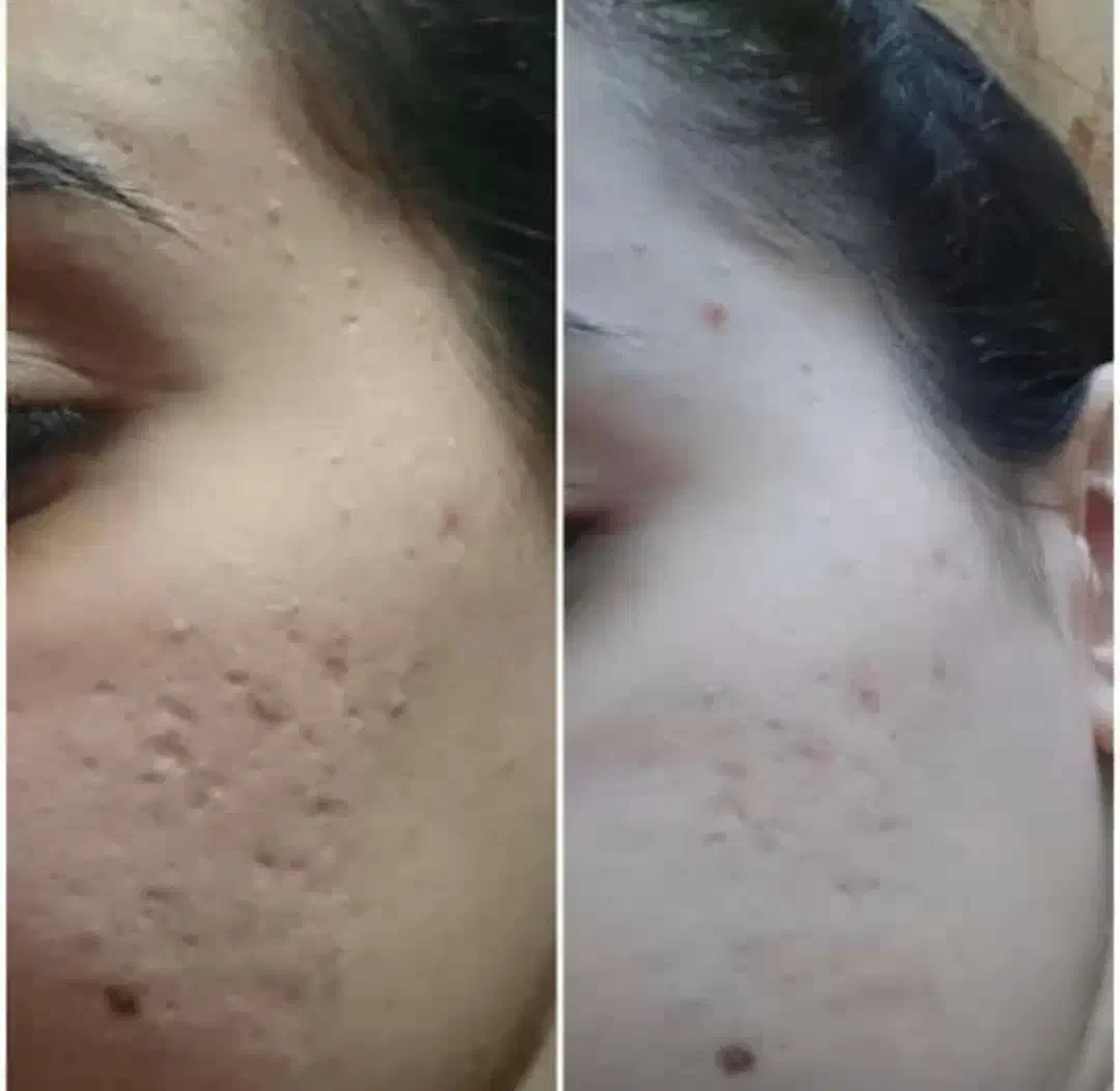 درمان ترک پا|آرایشی، بهداشتی، درمانی|شادگان, |دیوار