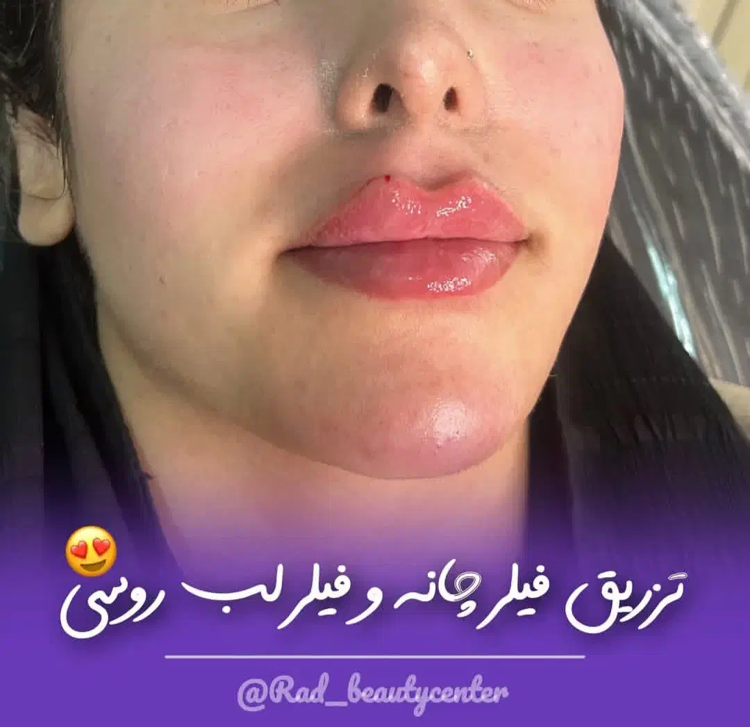 خدمات تخصصی زیبایی و مراقبت پوست و مو کلینیک راد|خدمات آرایشگری و زیبایی|تهران, صادقیه|دیوار