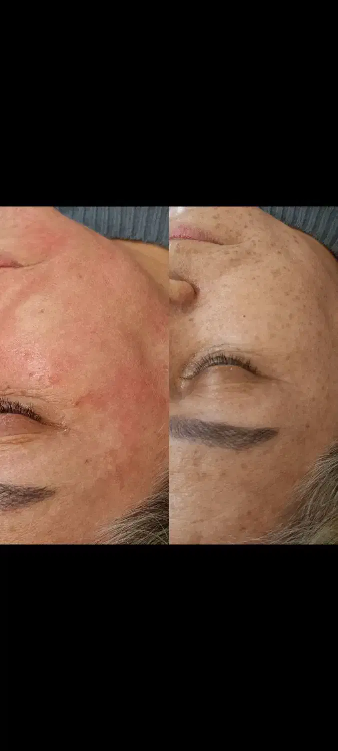 پزشکی آف ویژه|خدمات آرایشگری و زیبایی|بروجرد, |دیوار