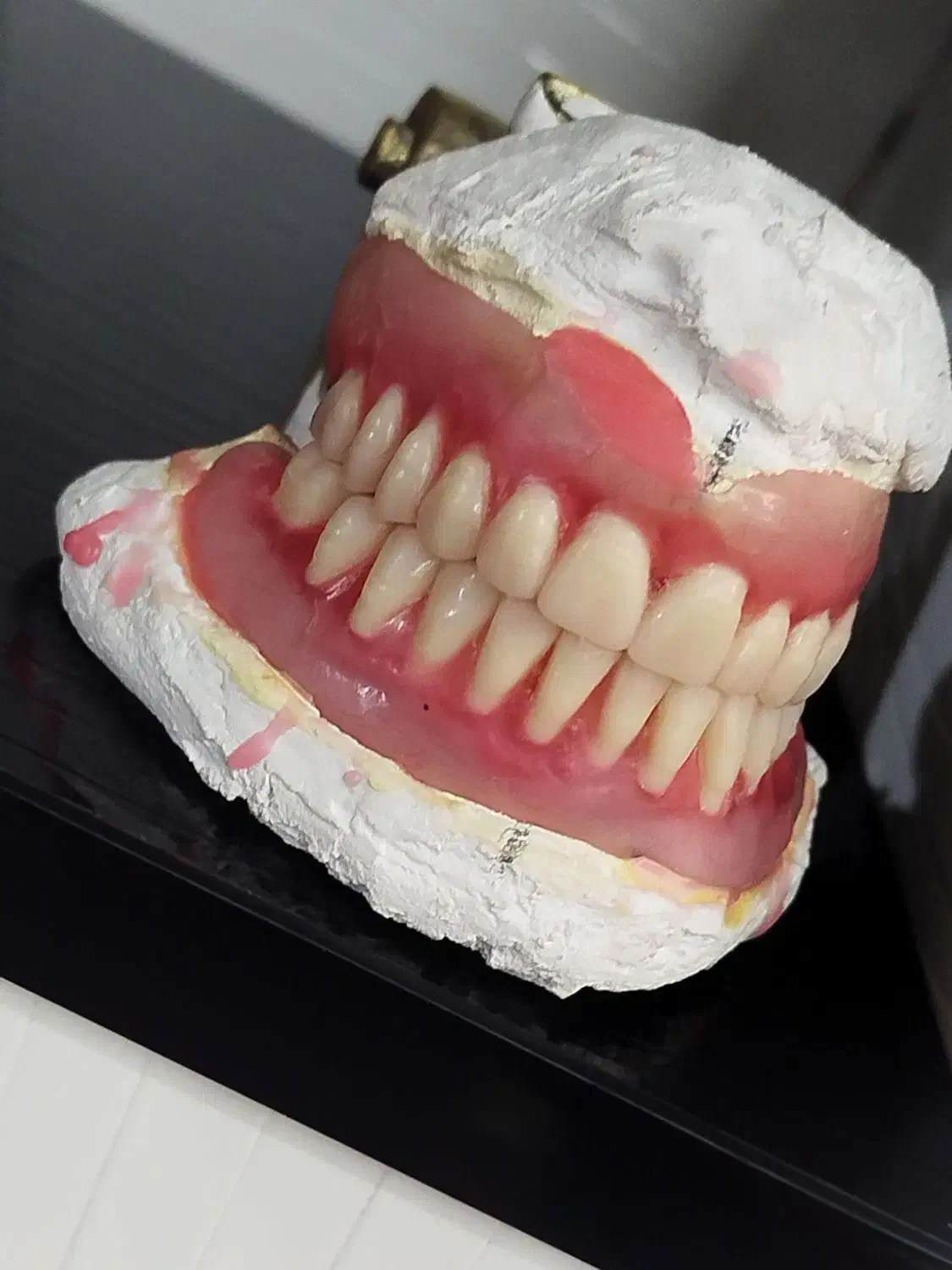 دندانسازی ،پروتر متحرک .دندان مصنوعی|خدمات آرایشگری و زیبایی|کرمانشاه, |دیوار