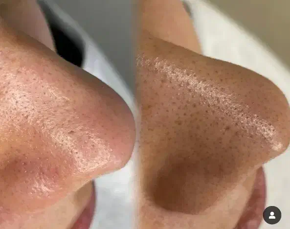 خدمات فشیال تخصصی خانوم وآقا|خدمات آرایشگری و زیبایی|سنندج, |دیوار