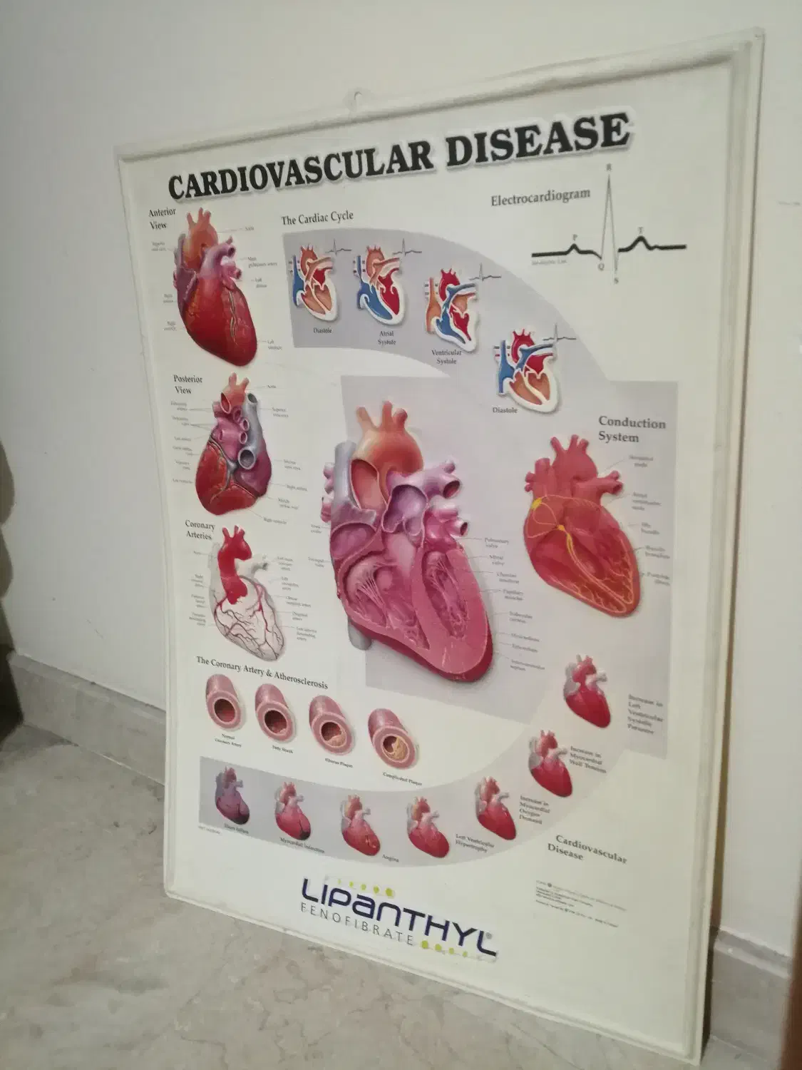 اطلس دیواری قلب، پوستر|تابلو، نقاشی، عکس|تهران, پاسداران|دیوار