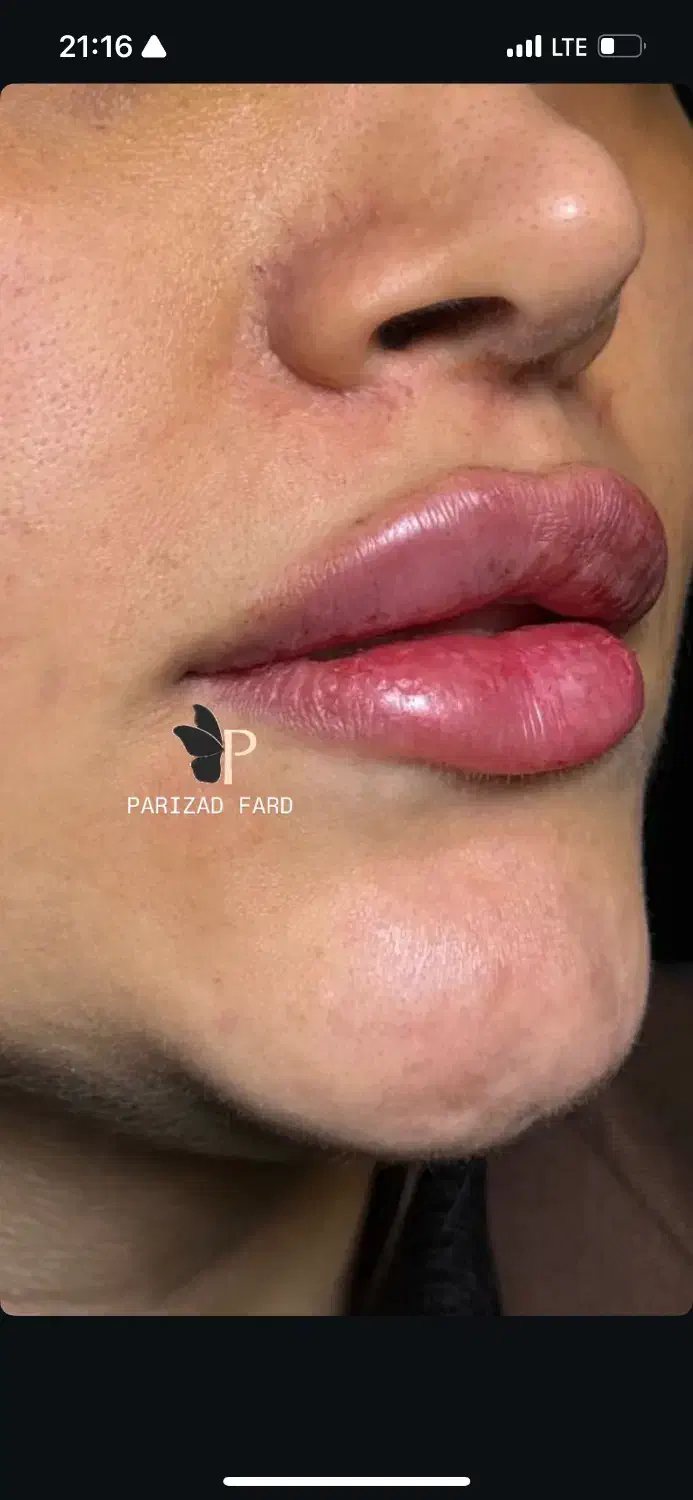 مدل|استخدام درمانی، زیبایی، بهداشتی|تهران, نازی‌آباد|دیوار