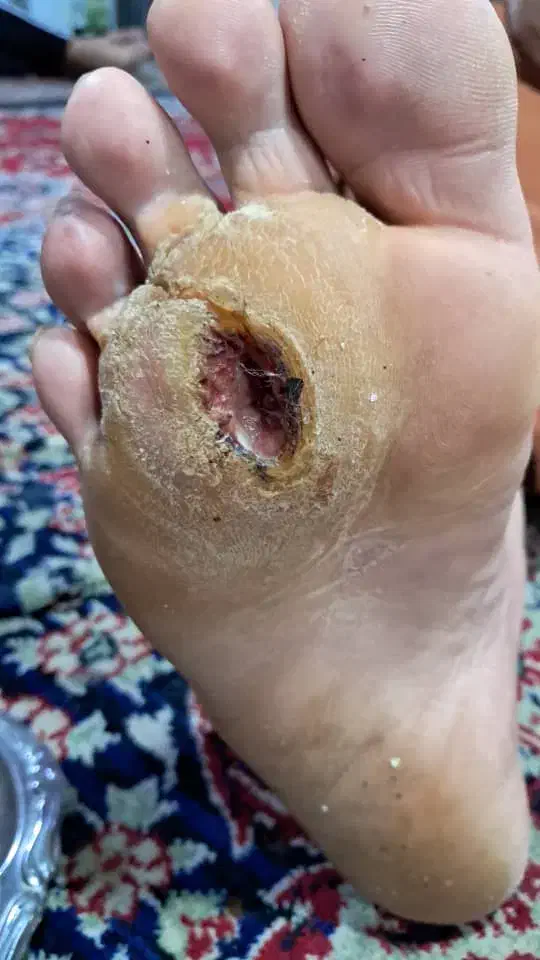 زیبایی درمانی|خدمات آرایشگری و زیبایی|بوشهر, |دیوار