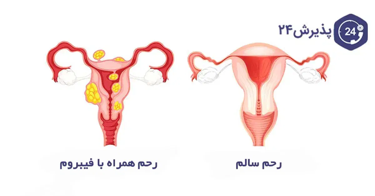 درمان تضمینی وقطعی مشکلات رحم|آرایشی، بهداشتی، درمانی|قم, نیروگاه|دیوار