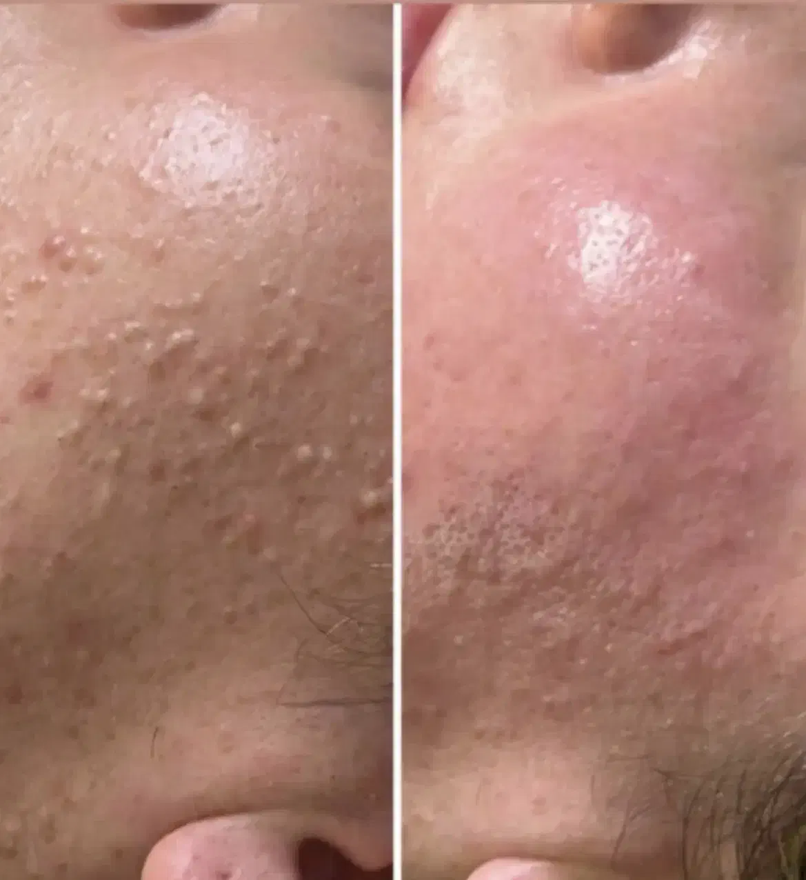 فیشال تخصصی خانم ها واقایان تحت نظر پزشک|خدمات آرایشگری و زیبایی|زاهدان, |دیوار