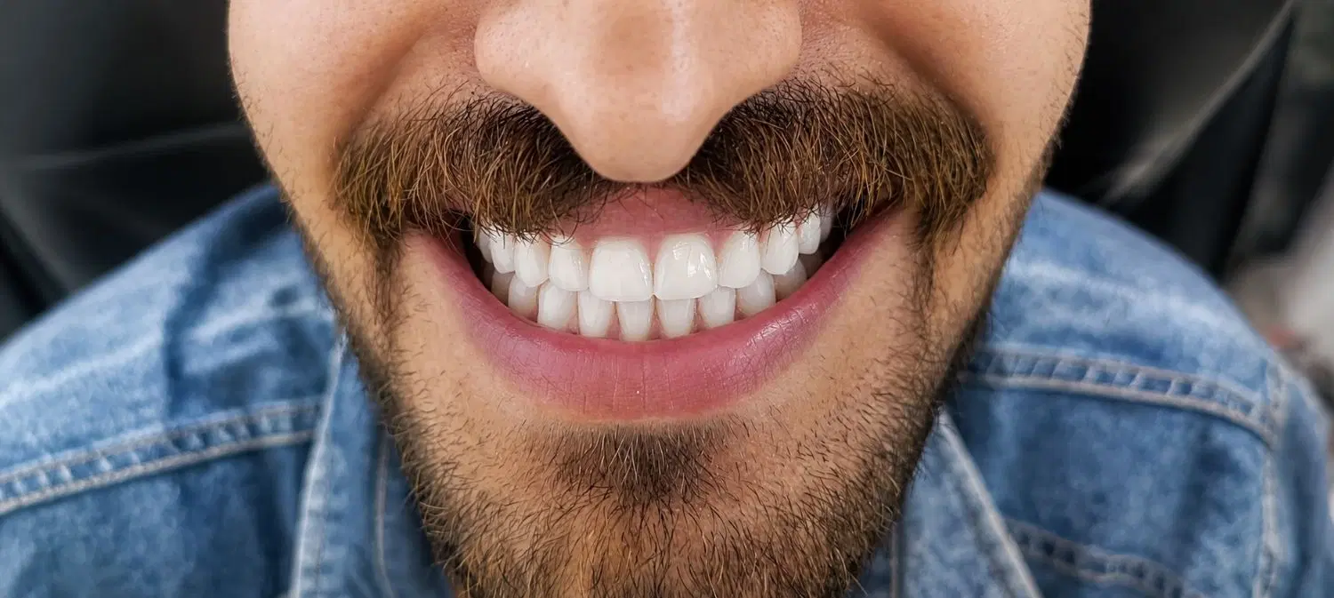 دندانسازی ، دندان مصنوعی|خدمات زیبایی و سلامت|تهران, شادآباد|دیوار