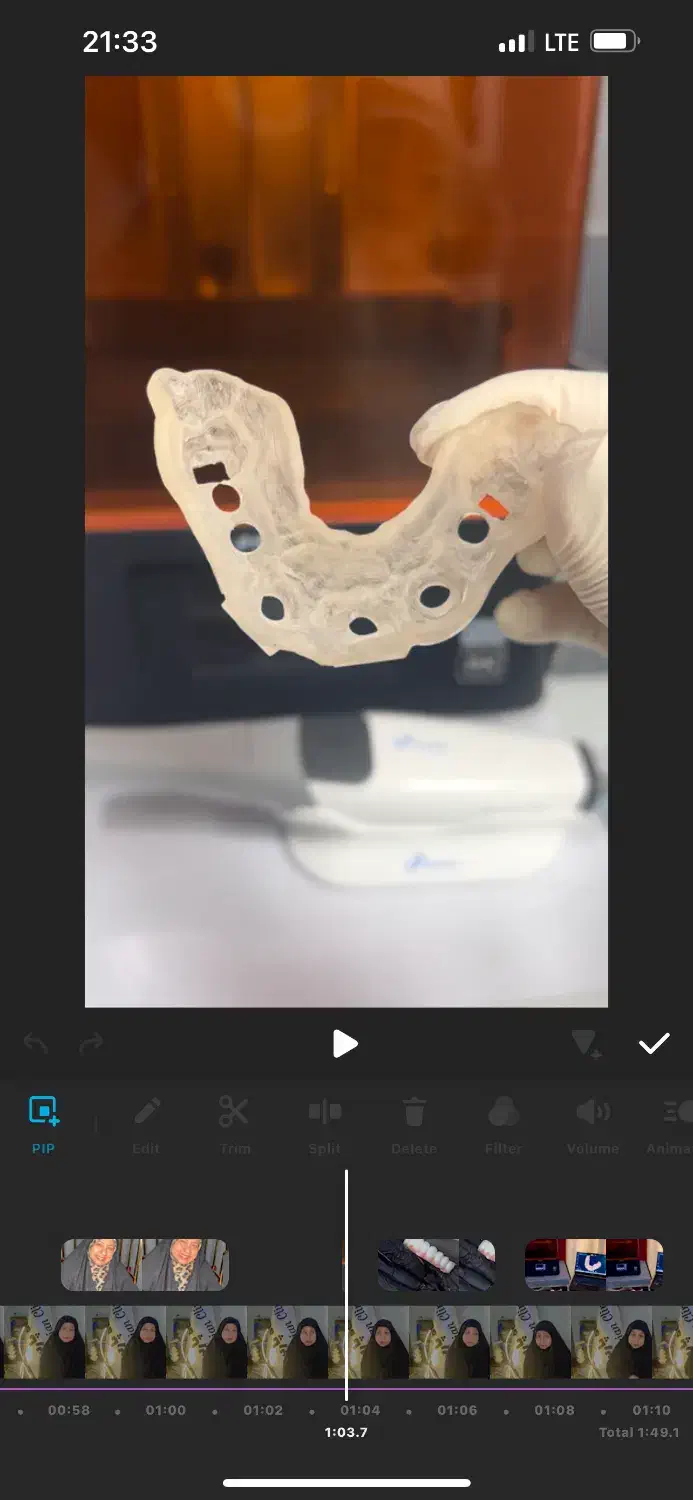 ایمپلنت دیجیتال|خدمات آرایشگری و زیبایی|قم, نیروگاه|دیوار