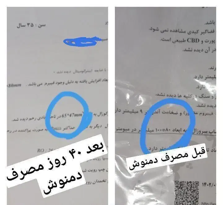 درمان تضمینی کبدجرب بامحصولات گیاهی شرکت کاژان|خوردنی و آشامیدنی|رباط‌کریم, شهرک صنعتی نصیرآباد|دیوار