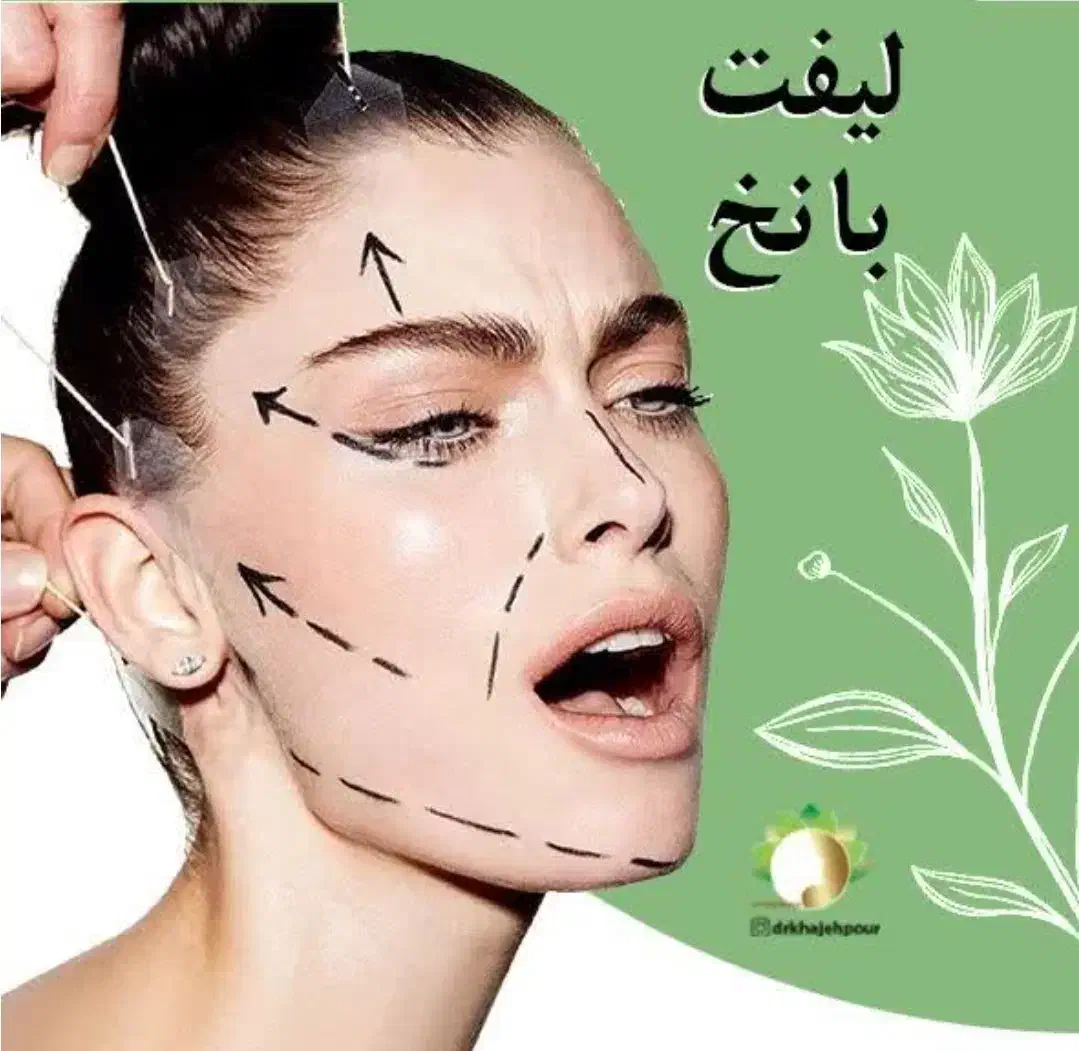 مدل لیفت با نخ|خدمات آرایشگری و زیبایی|سنندج, |دیوار