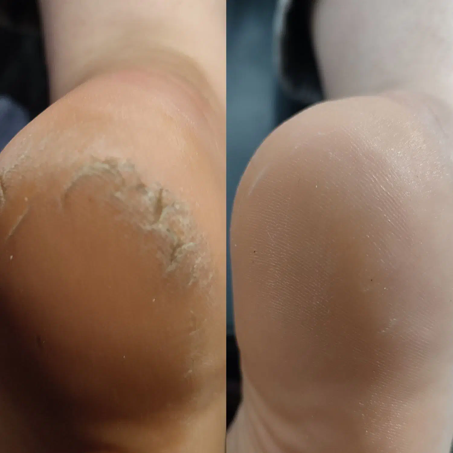 پدیکور خشک و پاکسازی صورت بانوان|خدمات آرایشگری و زیبایی|رشت, معلم|دیوار