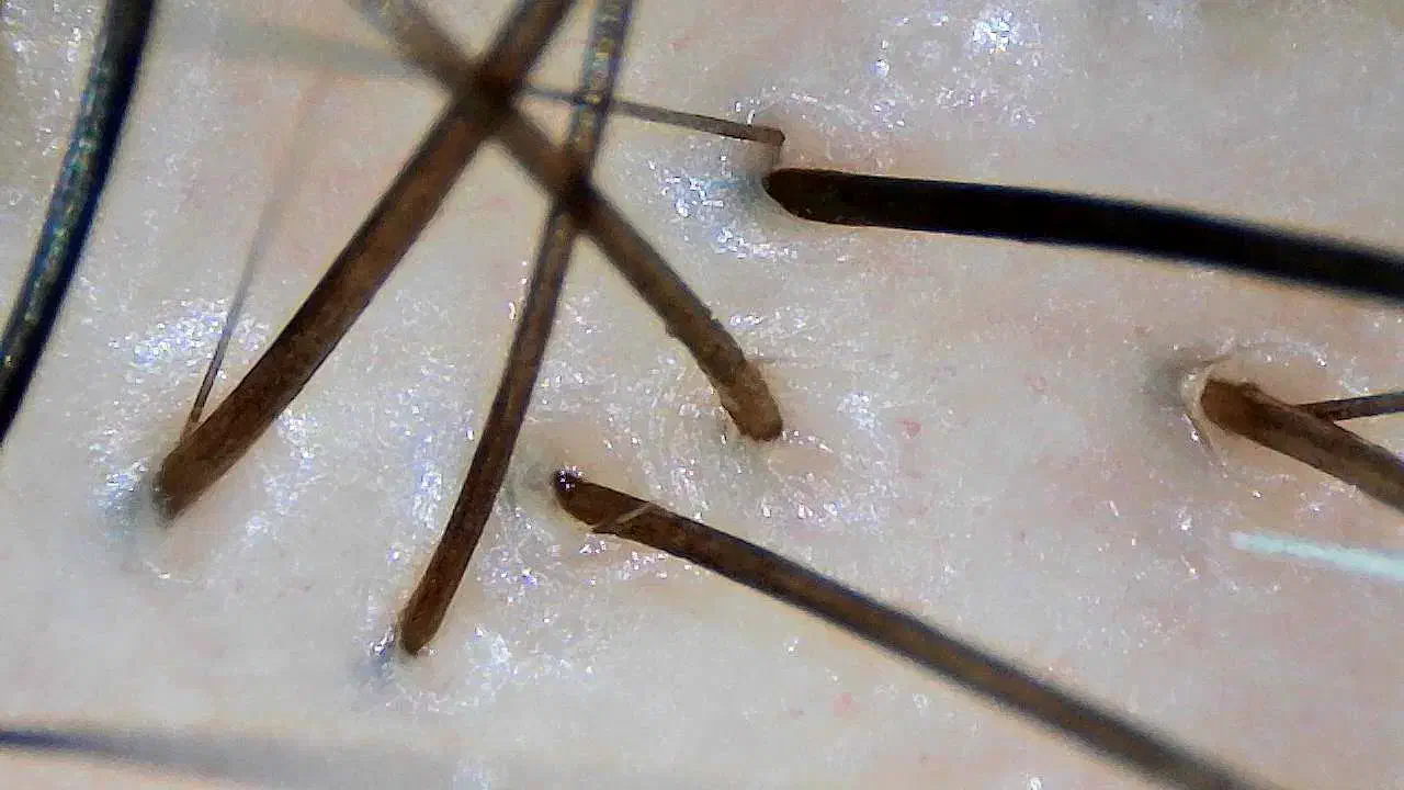 پاکسازی کف سر تخصصی / کراتین و پروتئین|خدمات آرایشگری و زیبایی|اصفهان, کوی ولی عصر|دیوار