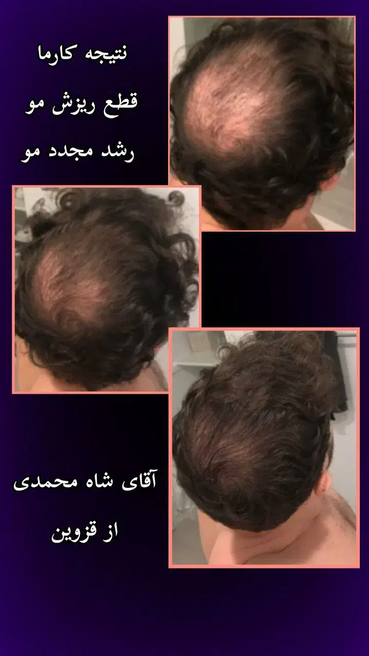 مشاوره تخصصی پوست و مو|آرایشی، بهداشتی، درمانی|تهران, دهم فروردین|دیوار