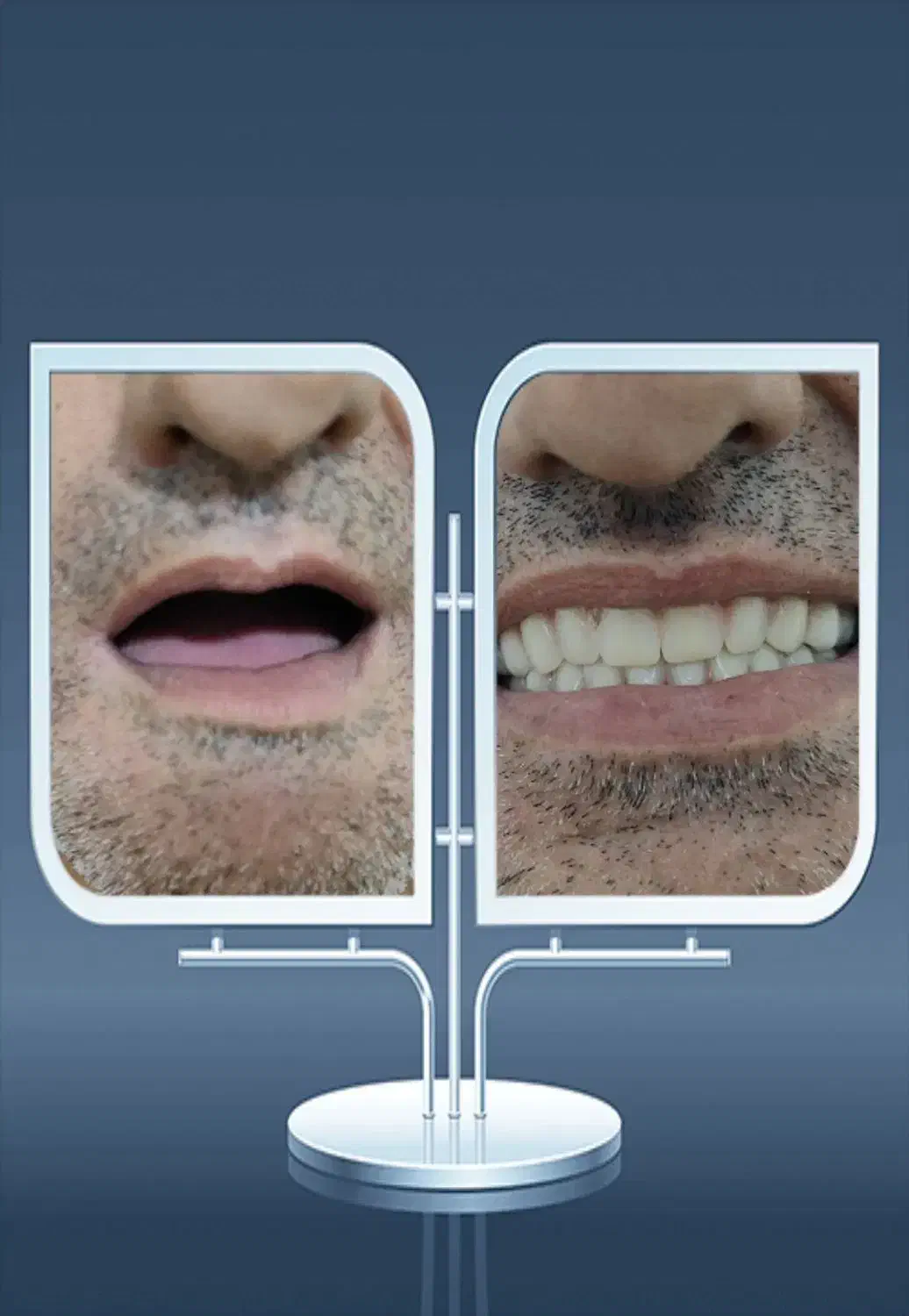 دندان مصنوعی|آرایشی، بهداشتی، درمانی|لردگان, |دیوار