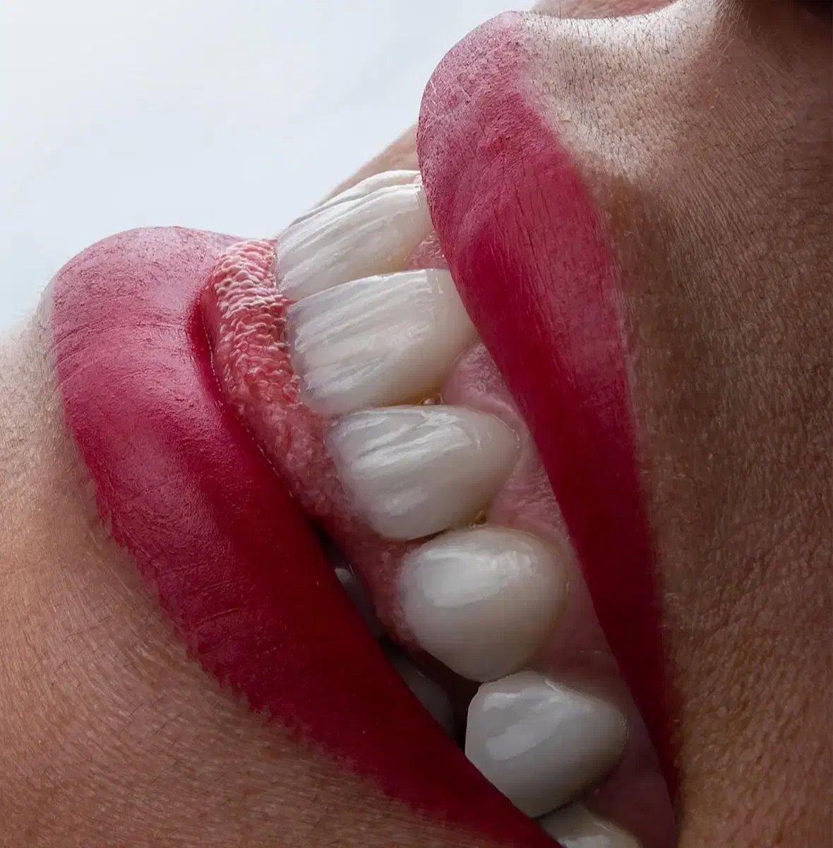 ایمپلنت8 تومن/کامپوزیت2تومن/عصب کشی/لمینت|خدمات آرایشگری و زیبایی|مشهد, سجاد شهر|دیوار