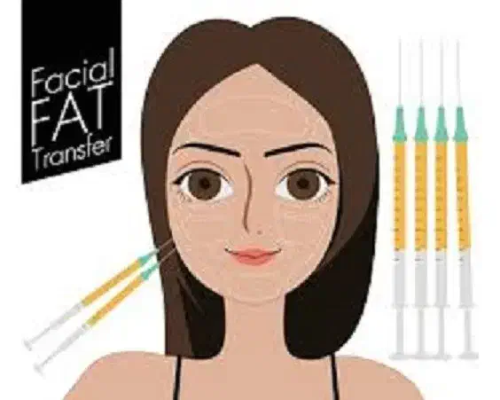 آفر تزریق چربی به صورت به همراه svf و نانوفت|خدمات آرایشگری و زیبایی|دوگنبدان, |دیوار