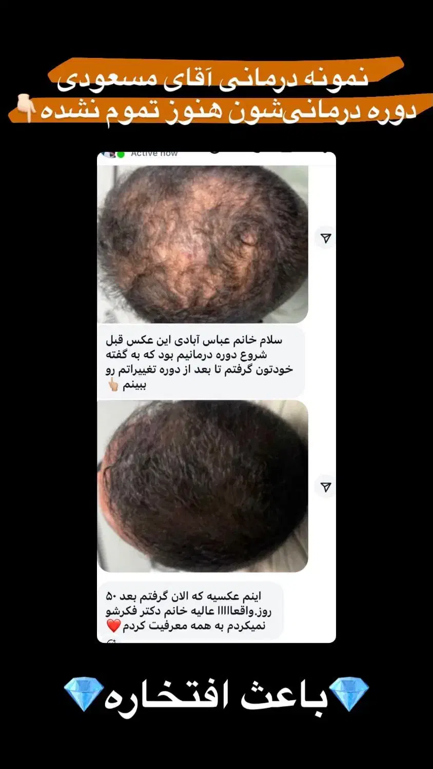 تونیک هیرفرند|آرایشی، بهداشتی، درمانی|ایلخچی, |دیوار