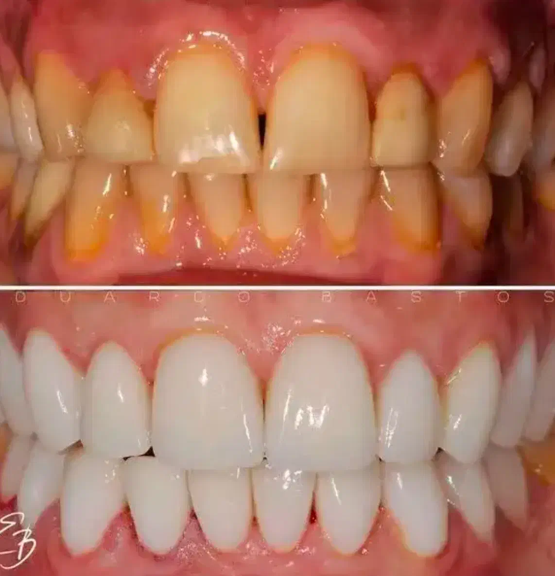 جشنواره کامپوزیت،لمینیت وبلیچینگ وخدمات دندانپزشکی|خدمات آرایشگری و زیبایی|شاهین‌شهر, مخابرات (شهید بهشتی)|دیوار