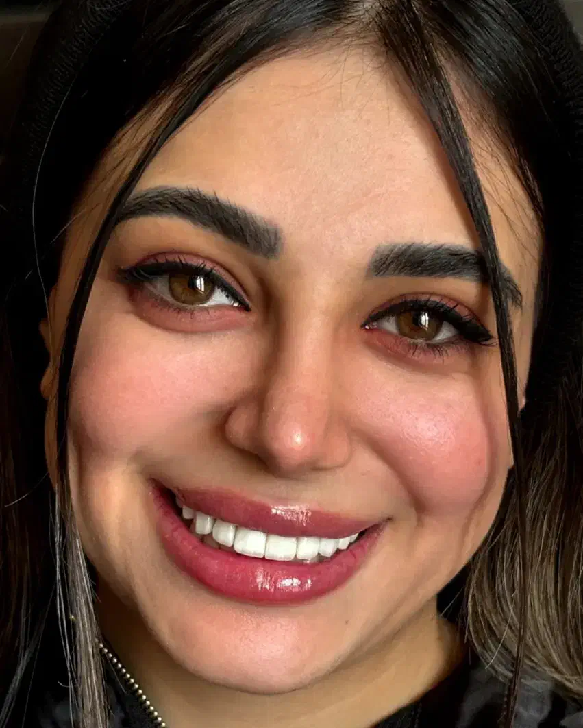 زیبایی دندان و ترمیم و درمان تخصصی|خدمات آرایشگری و زیبایی|ملارد, |دیوار