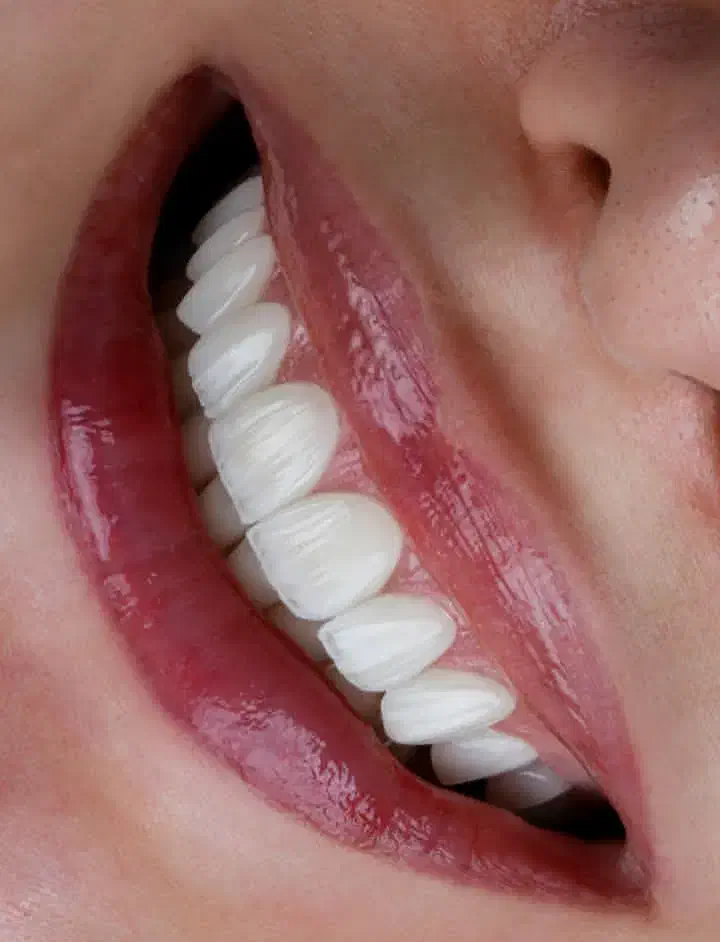 دندانپزشکی از دم قسط ایمپلنت کامپوزیت عصبکشی روکش|خدمات آرایشگری و زیبایی|خرمآباد, |دیوار