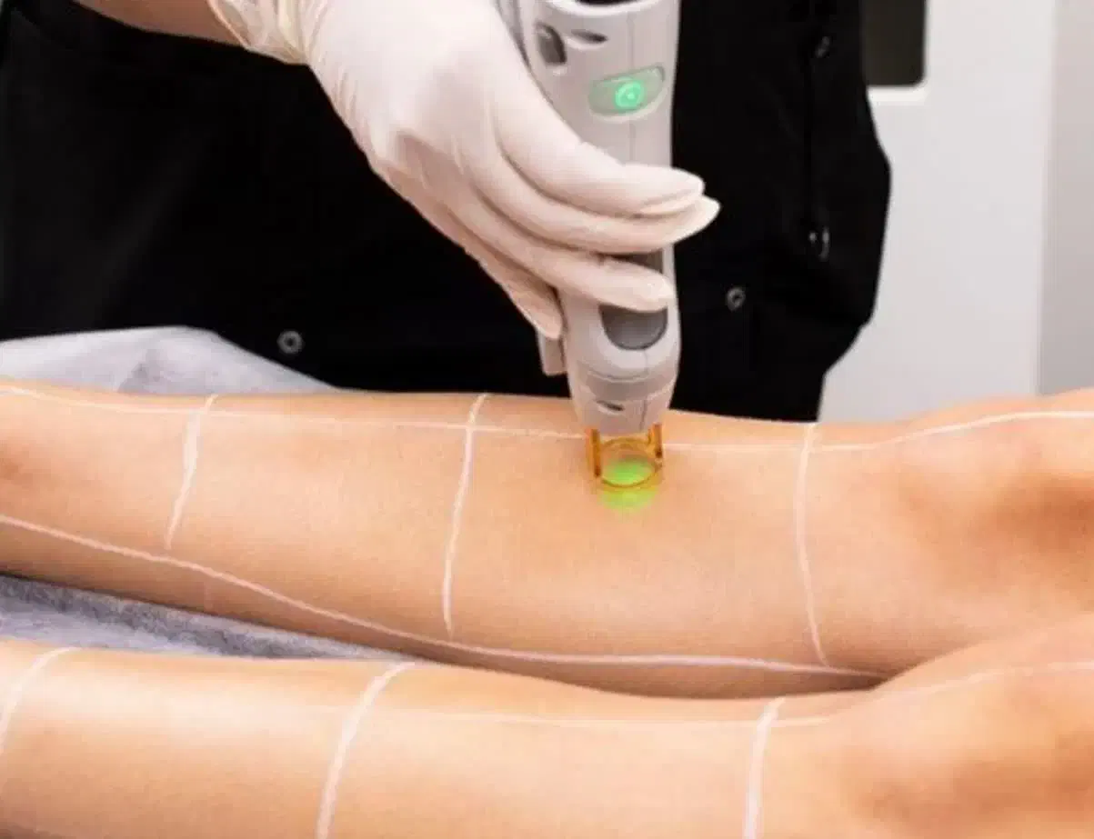 جشنواره مرکز کلینیک لیزر|خدمات آرایشگری و زیبایی|نجف‌آباد, بازار|دیوار