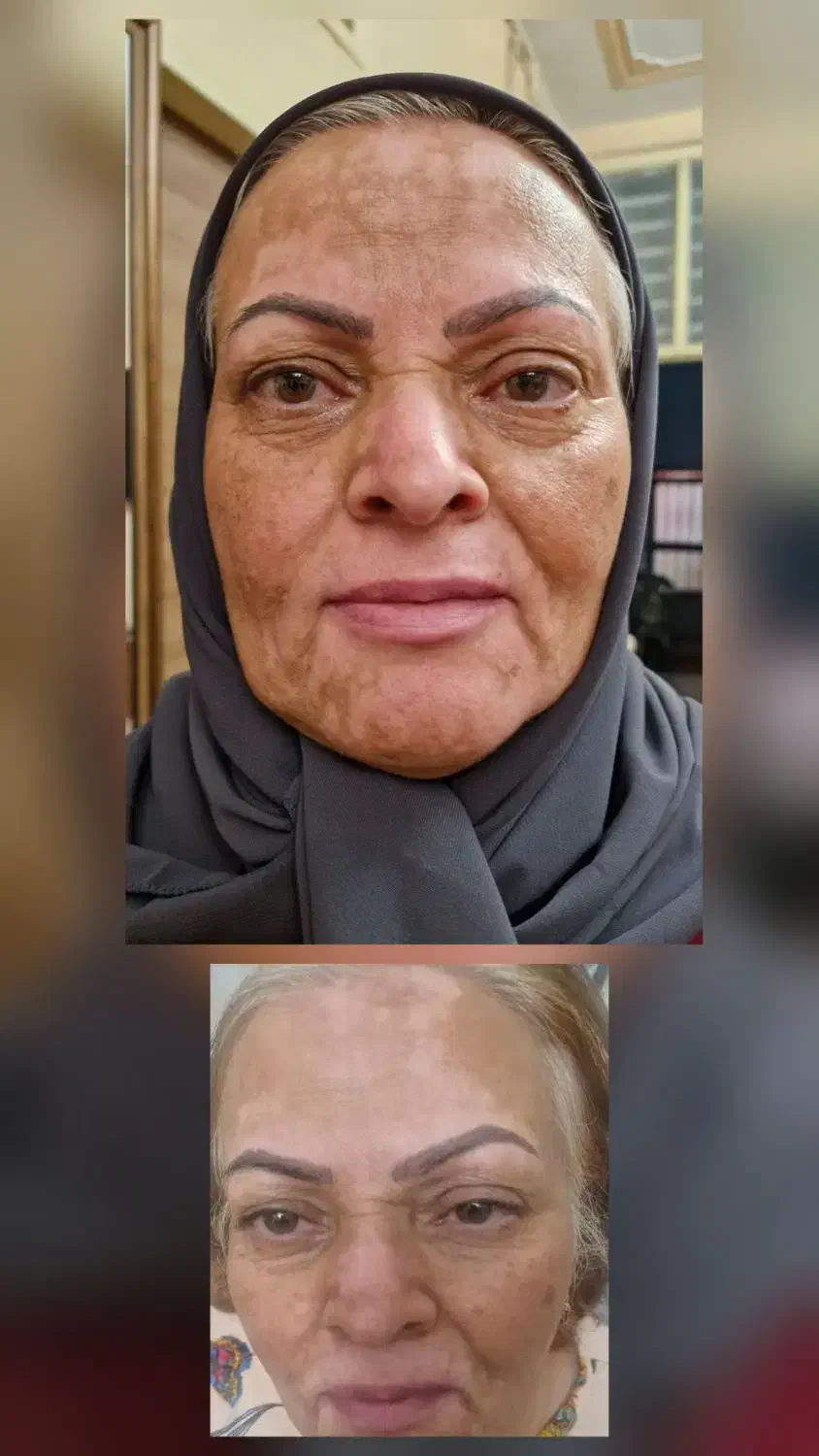 روغن خوراکی|خوردنی و آشامیدنی|برهسر, |دیوار