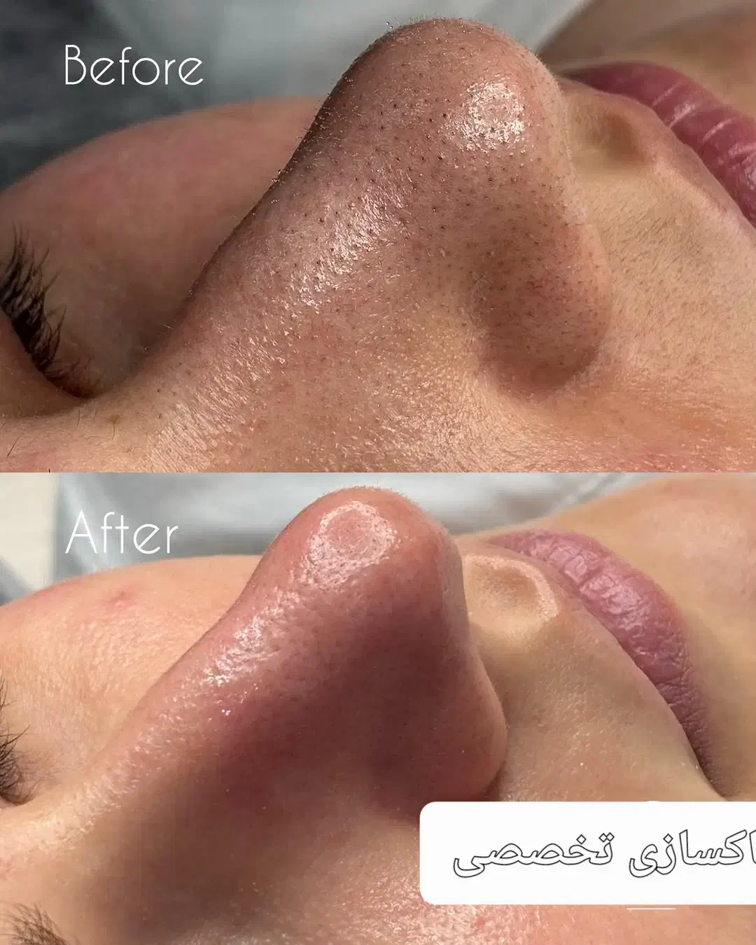 پاکسازی تخصصی تخفیف تا یک هفته|خدمات آرایشگری و زیبایی|گتوند, |دیوار