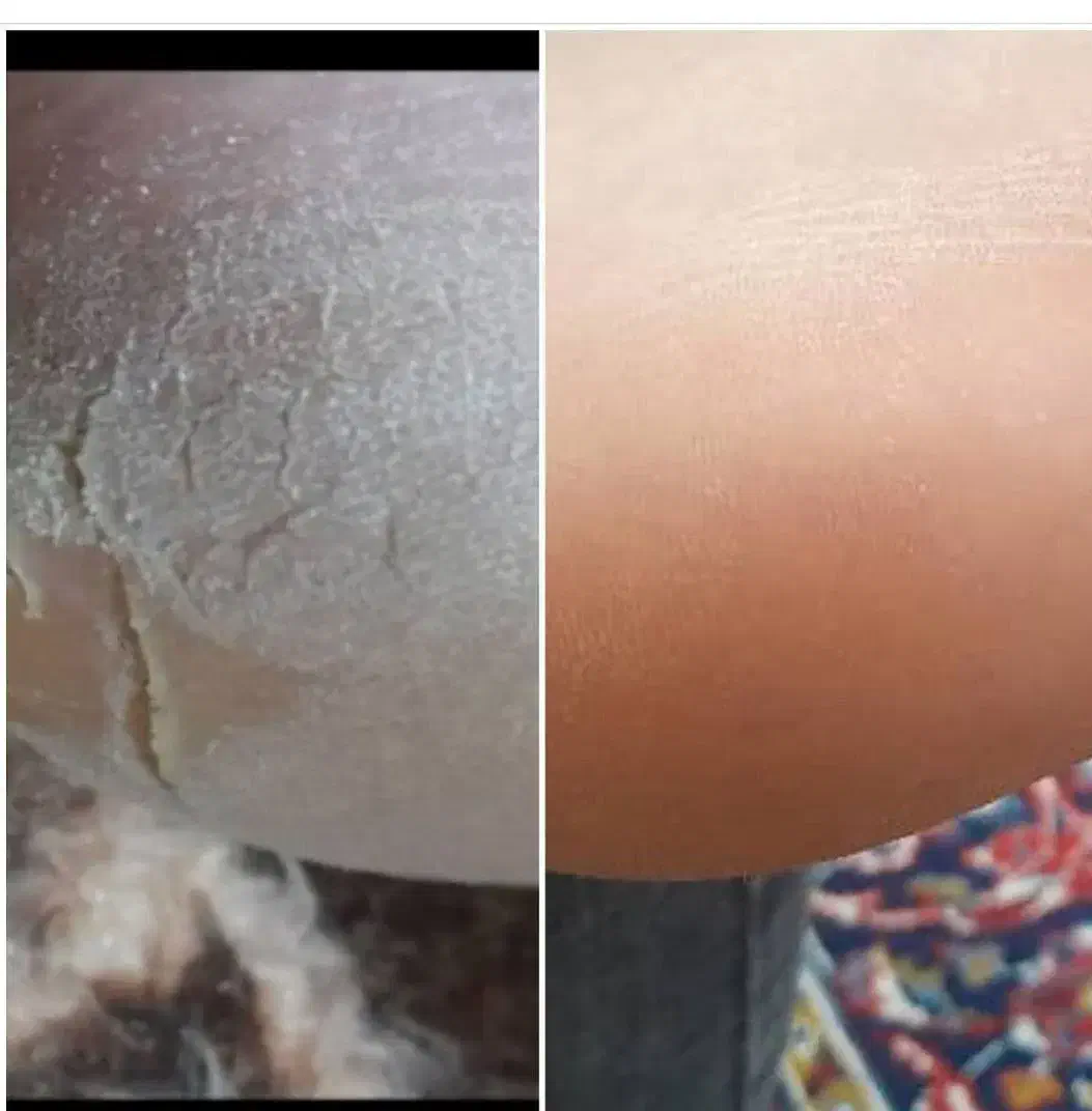 محصولات لدورا|آرایشی، بهداشتی، درمانی|چابکسر, |دیوار