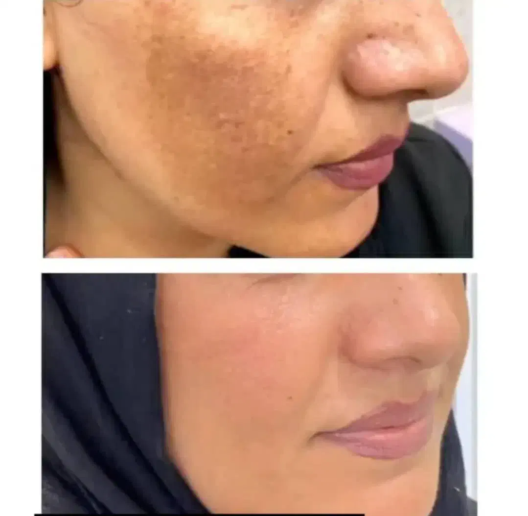 کرم اماراتی عصل مروه گلی|آرایشی، بهداشتی، درمانی|میبد, |دیوار