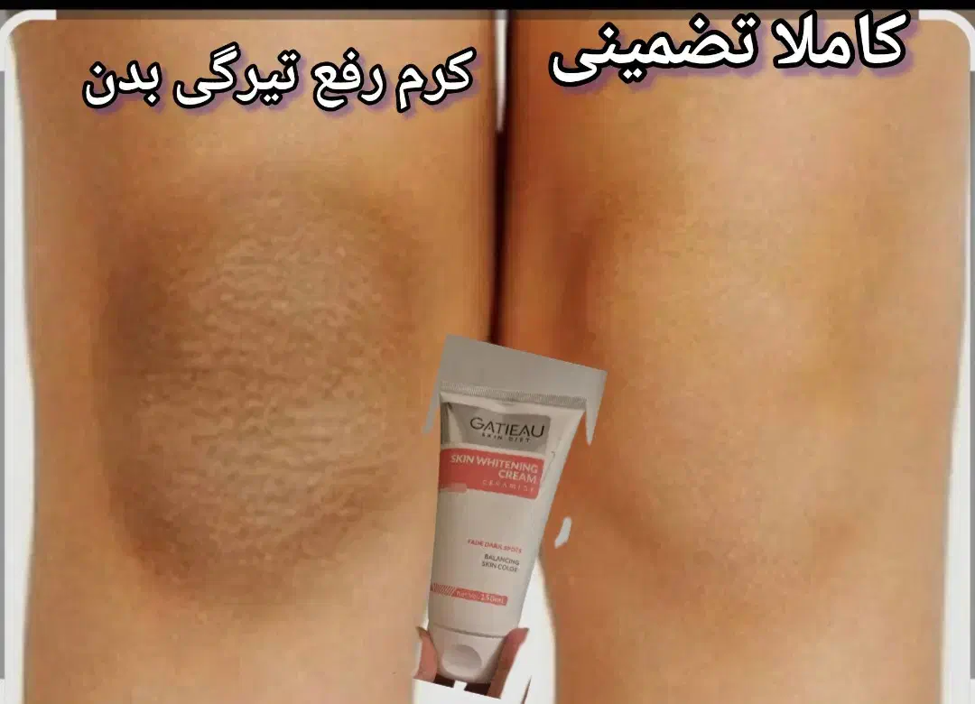 کرم رفع تیرگی گاتیو کاملا گیاهی|آرایشی، بهداشتی، درمانی|شیراز, نصر|دیوار