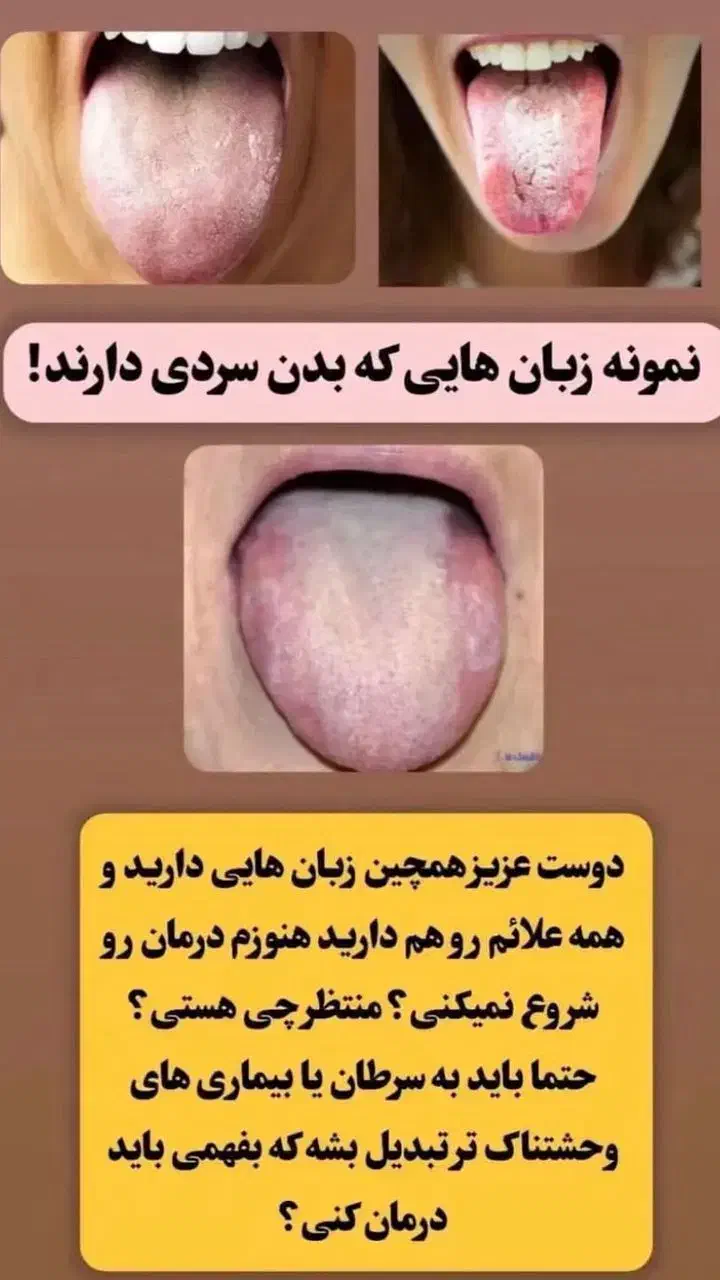 سردی و بلغم|آرایشی، بهداشتی، درمانی|اهواز, سیصد دستگاه|دیوار