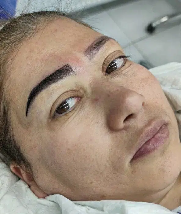 میکرو کاشت ابرو با تخفیف ویژه در کازرون، میدان شهدا