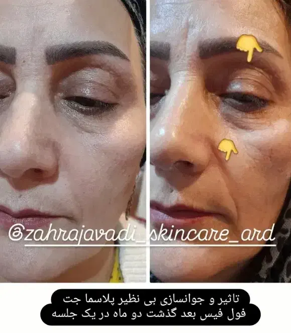 تخفیف روز مادر|آرایشی، بهداشتی، درمانی|مسجد سلیمان, |دیوار