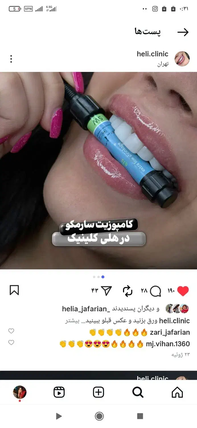 کامپوزیت دندان فکی ۸ میلیون با ضمانت ده ساله|خدمات آرایشگری و زیبایی|قزوین, |دیوار