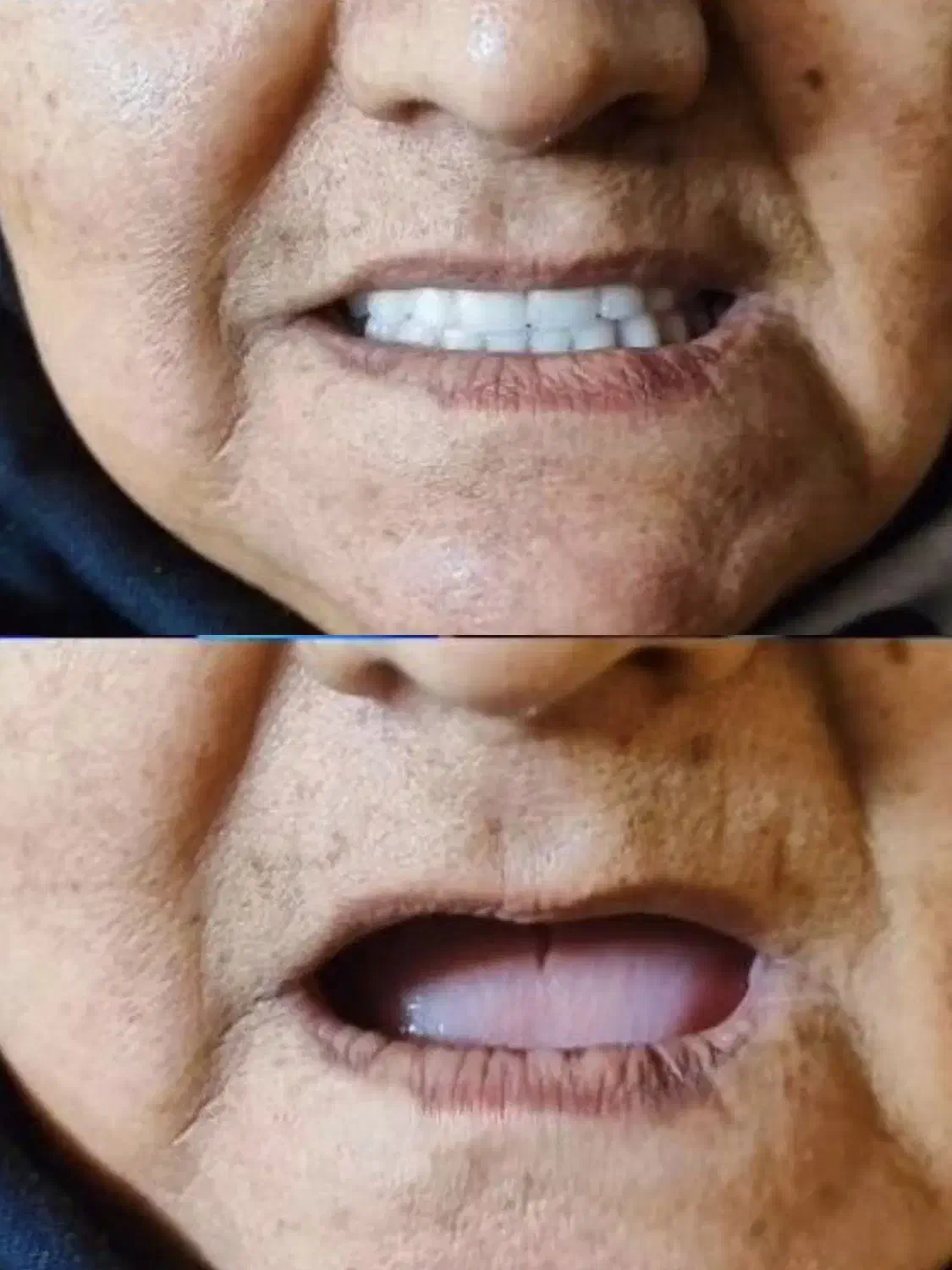 ساخت دندان مصنوعی متحرک فول دنچر|خدمات آرایشگری و زیبایی|لردگان, |دیوار