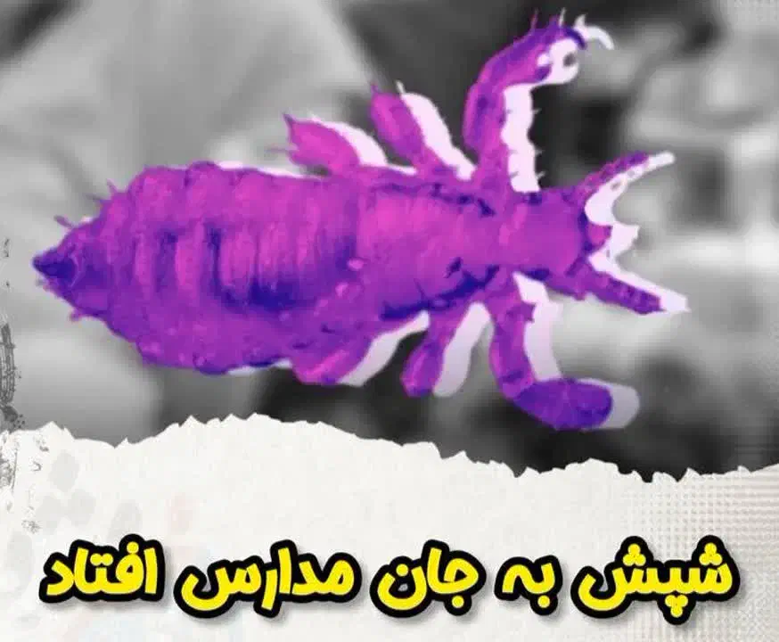 شپش|آرایشی، بهداشتی، درمانی|اصفهان, باغ فردوس|دیوار